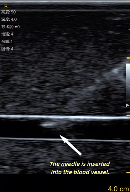Ultrasound Vascular Puncture T - огляд і ціна Medical Gel Ultrasound